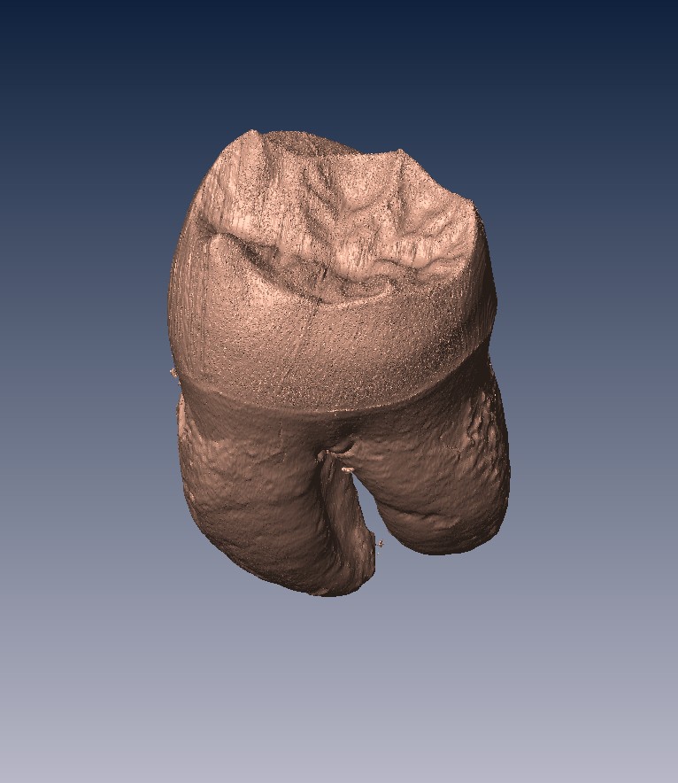 Human Molar Tooth: Dentin