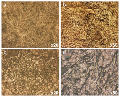 Figure 1: Remodeling activities under Reflected Light Microscope. a) Depository fields with fibers of collagen, b) Depository (left) and resorptive (right) areas c) and d) Resorptive surface with characteristic Howship´s lacunae.