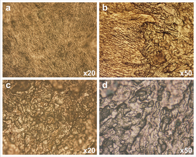 Figure 1: Remodeling activities under Reflected Light Microscope. a) Depository fields with fibers of collagen, b) Depository (left) and resorptive (right) areas c) and d) Resorptive surface with characteristic Howship´s lacunae.