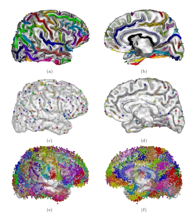 Cortical landmarks