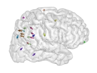 Loadings on cortical landmarks, asymmetry analysis